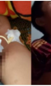 Diduga Malpraktik, Bocah di Kerinci Kehilangan Alat Kelamin Usai Sunat Laser